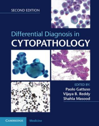 Carte Differential Diagnosis in Cytopathology Book and Online Bundle 
