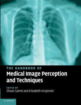 Carte Handbook of Medical Image Perception and Techniques Elizabeth Krupinski