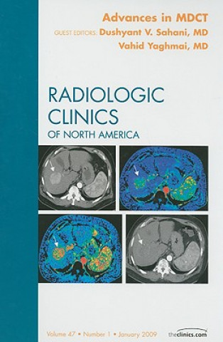 Książka Advances in MDCT, An Issue of Radiologic Clinics Vahid Yaghmai