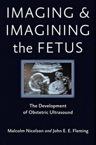 Carte Imaging and Imagining the Fetus Malcolm Nicolson