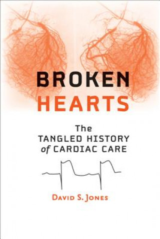 Kniha Broken Hearts David S. Jones