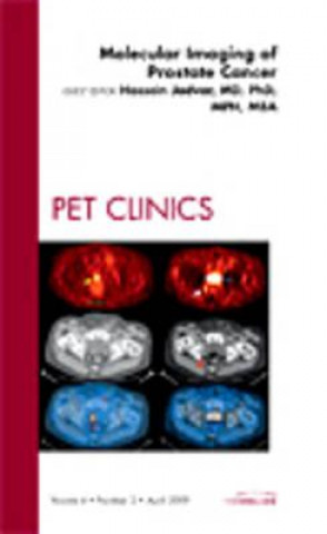 Könyv Molecular Imaging of Prostate Cancer, An Issue of PET Clinics Hossein Jadvar