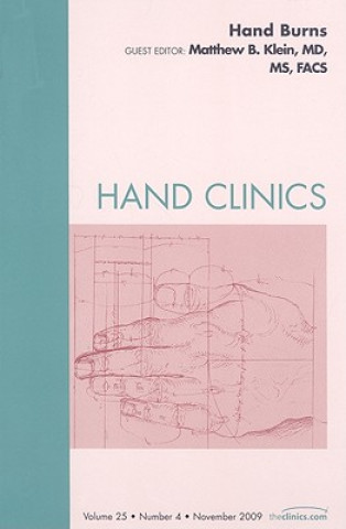 Kniha Hand Burns, An Issue of Hand Clinics Matthew B. Klein