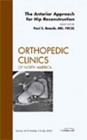 Książka Anterior Approach for Hip Reconstruction, An Issue of Orthopedic Clinics Paul E. Beaule