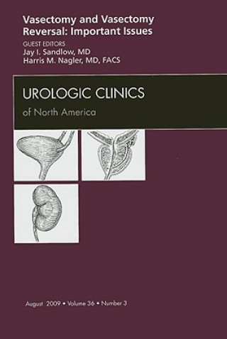 Knjiga Vasectomy and Vasectomy Reversal: Important Issues, An Issue of Urologic Clinics Jay I. Sandlow