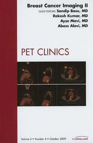 Книга Breast Cancer Imaging II, An Issue of PET Clinics Rakesh Kumar