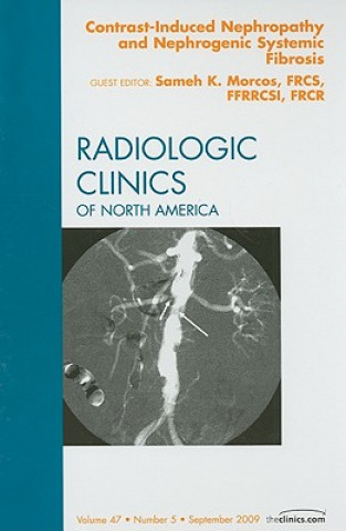 Książka Contrast-Induced Nephropathy and Nephrogenic Systemic Fibrosis, An Issue of Radiologic Clinics of North America Sameh K. Morcos