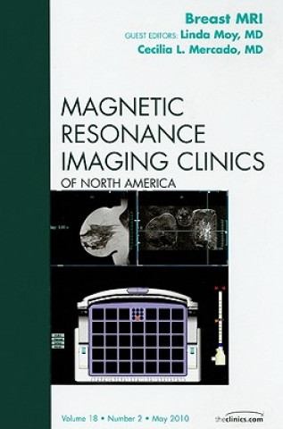 Buch Breast MRI, An Issue of Magnetic Resonance Imaging Clinics Linda Moy