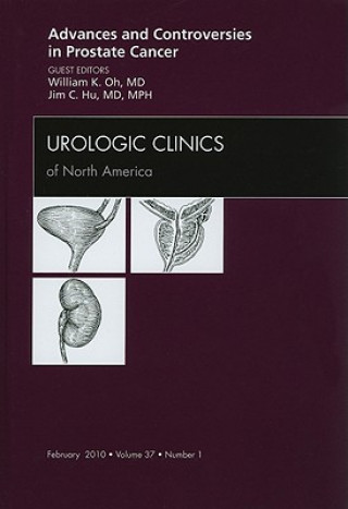 Könyv Advances and Controversies in Prostate Cancer, An Issue of Urologic Clinics William K. Oh