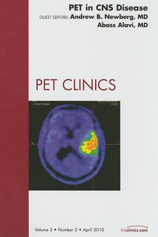 Kniha PET in CNS Disease, An Issue of PET Clinics Andrew B. Newberg