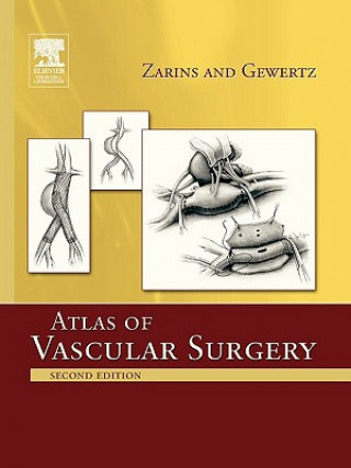 Könyv Atlas Of Vascular Surgery - Paperback Edition Christopher K. Zarins