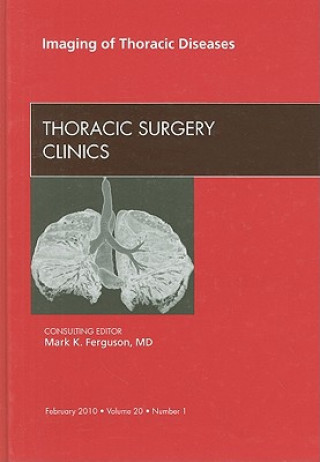 Carte Imaging of Thoracic Diseases, An Issue of Thoracic Surgery Clinics Mark K. Ferguson