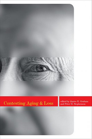 Carte Contesting Aging and Loss 