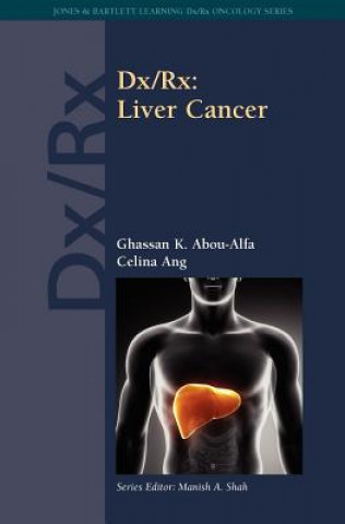 Livre Dx/Rx: Liver Cancer Ghassan K. Abou-Alfa