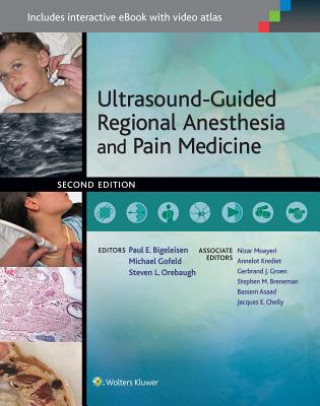 Książka Ultrasound-Guided Regional Anesthesia and Pain Medicine Paul E. Bigeleisen