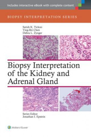 Książka Biopsy Interpretation of the Kidney & Adrenal Gland Satish Tickoo
