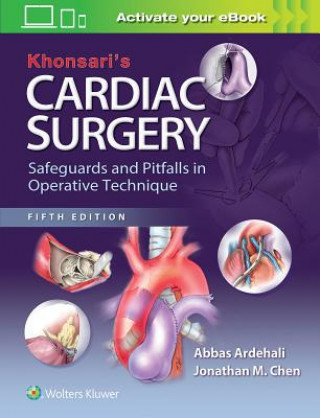 Könyv Khonsari's Cardiac Surgery: Safeguards and Pitfalls in Operative Technique Abbas Ardehali
