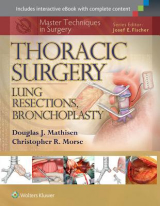 Kniha Master Techniques in Surgery: Thoracic Surgery: Lung Resections, Bronchoplasty Douglas J. Mathisen