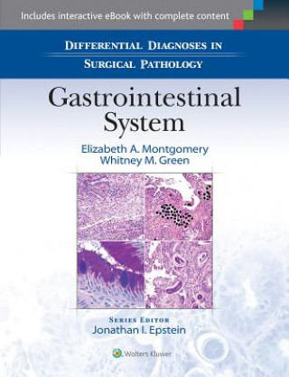 Kniha Differential Diagnoses in Surgical Pathology: Gastrointestinal System Elizabeth A. Montgomery