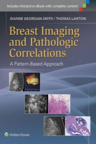 Kniha Breast Imaging and Pathologic Correlations Dianne Georgian-Smith