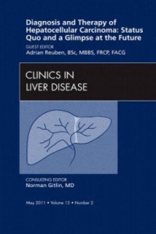 Kniha Diagnosis and Therapy of Hepatocellular Carcinoma: Status Quo and a Glimpse at the Future, An Issue of Clinics in Liver Disease Adrian Reuben