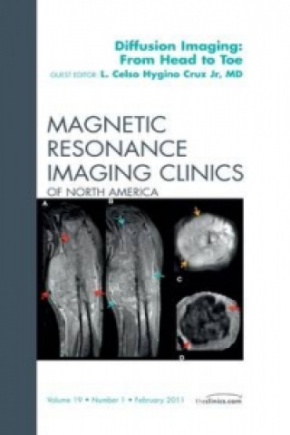 Książka Clinical Applications of Diffusion Imaging: from Head to Toe, An Issue of Magnetic Resonance Imaging Clinics Celso Hygino