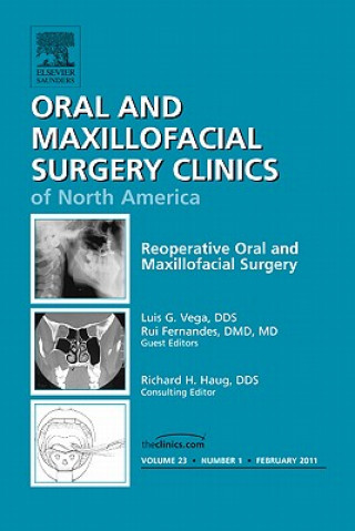 Könyv Reoperative Oral and Maxillofacial Surgery, An Issue of Oral and Maxillofacial Surgery Clinics Rui Fernandes