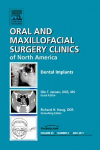 Buch Dental Implants, An Issue of Oral and Maxillofacial Surgery Clinics Ole T. Jensen