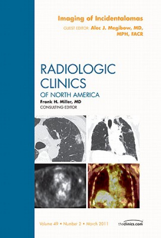 Kniha Imaging of Incidentalomas, An Issue of Radiologic Clinics of North America Alec Megibow