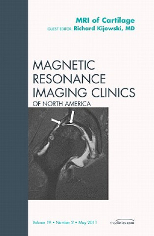 Könyv MRI of Cartilage, An Issue of Magnetic Resonance Imaging Clinics Richard Kijowski