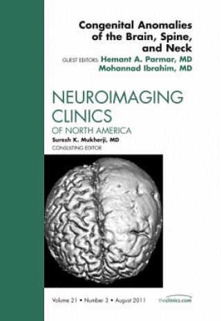 Kniha Congenital Anomalies of the Brain, Spine, and Neck, An Issue of Neuroimaging Clinics Hermant Parmar