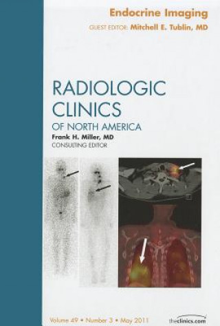 Knjiga Endocrine Imaging, An Issue of Radiologic Clinics of North America Mitchell E. Tublin