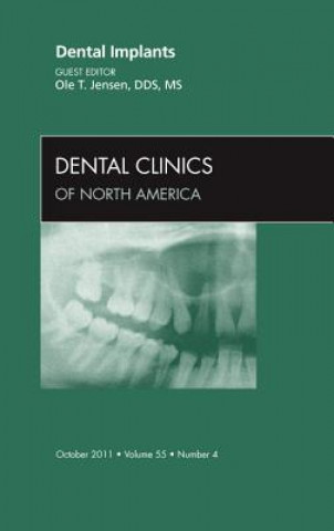 Könyv Dental Implants, An Issue of Dental Clinics Ole T. Jensen