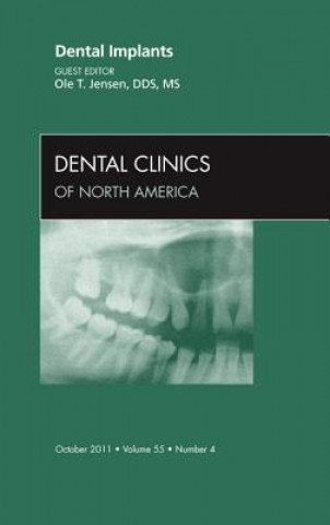 Libro Dental Implants, An Issue of Dental Clinics Ole T. Jensen