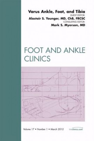 Könyv Varus Foot, Ankle, and Tibia, An Issue of Foot and Ankle Clinics Alastair S.E. Younger