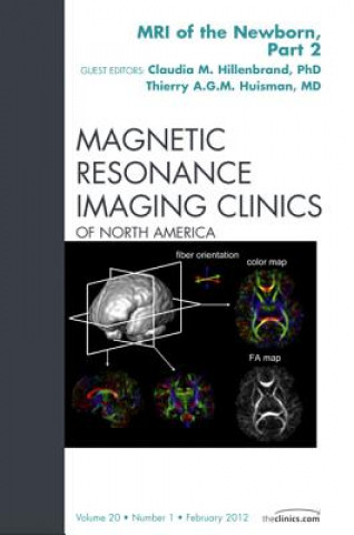 Könyv MRI of the Newborn, Part 2, An Issue of Magnetic Resonance Imaging Clinics Claudia M. Hillenbrand
