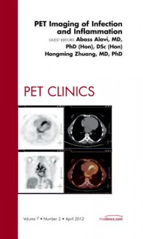 Książka PET Imaging of Infection and Inflammation, An Issue of PET Clinics Hongming Zhuang