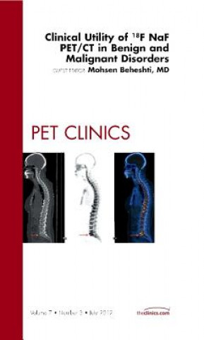 Könyv Clinical Utility of 18NaF PET/CT in Benign and Malignant Disorders, An Issue of PET Clinics Mohsen Beheshti