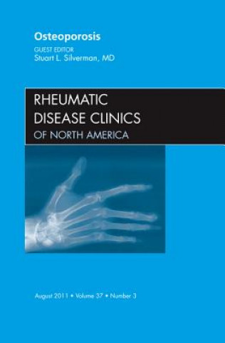 Könyv Osteoporosis, An Issue of Rheumatic Disease Clinics Stuart L. Silverman