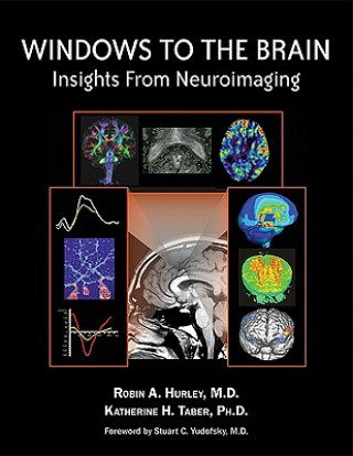 Boek Windows to the Brain Hurley