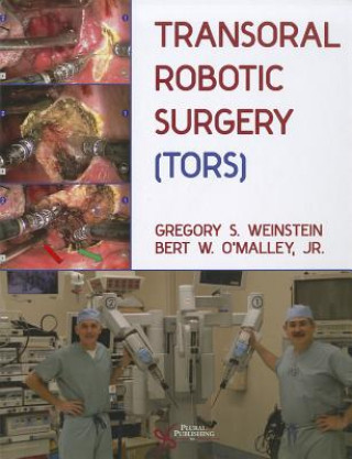 Carte Transoral Robotic Surgery (TORS) Bert W. O'Malley