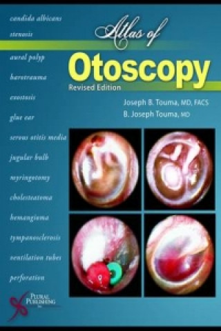 Książka Atlas of Otoscopy Joseph B. Touma