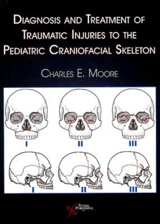 Carte Diagnosis and Treatment of Traumatic Injuries to the Pediatric Craniofacial Skeleton Charles E. Moore