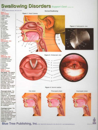 Digital Swallowing Disorders Sandy Kasper Schwartz