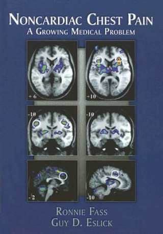 Knjiga Noncardiac Chest Pain Ronnie Fass