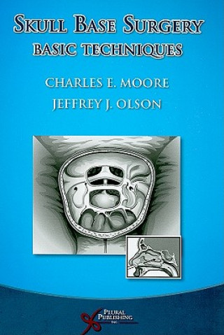 Knjiga Skull Base Surgery Jeffrey J. Olson
