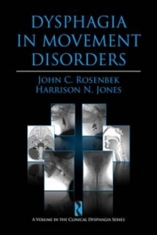 Kniha Dysphagia in Movement Disorders Harrison N. Jones