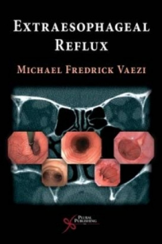 Könyv Extra Esophageal Reflux Michael F. Vaezi
