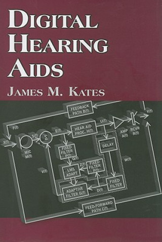 Buch Digital Hearing Aids James M. Kates