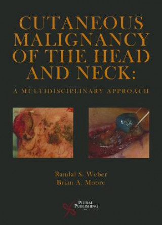 Knjiga Cutaneous Malignancy of the Head and Neck Randal S. Weber